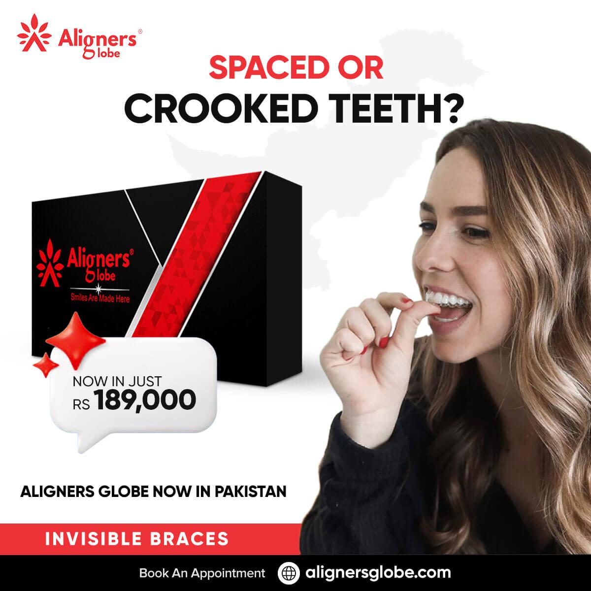 Invisible braces cost in Islamabad